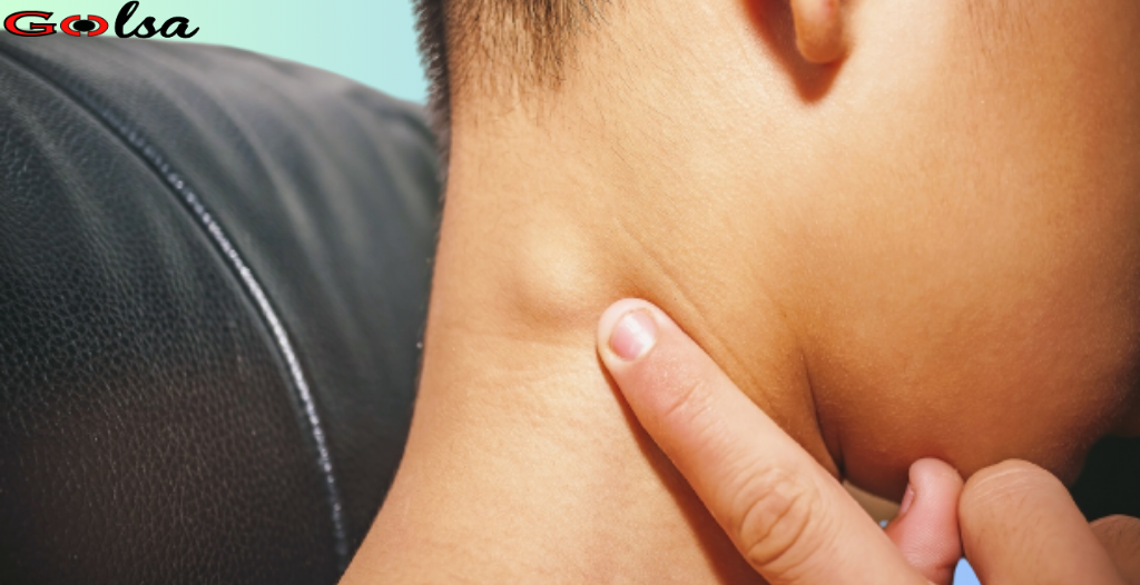 Do you have a lump in your neck, back, or behind your ear? Here’s what you need to know