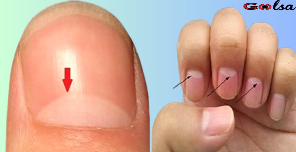 If you see this on your nails, see a doctor immediately!