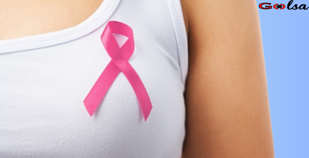 Common Misconceptions about Breast Cancer